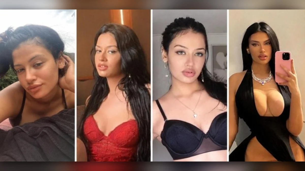 Sósia de Kylie: R$500 mil em cirurgias e não se reconhece