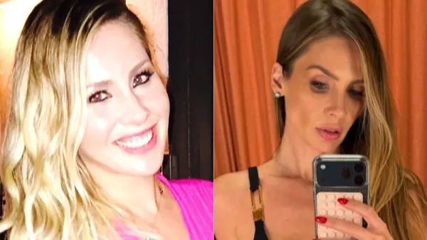 Ana Carolina Madeira revela antes e depois: perdeu 33 kg