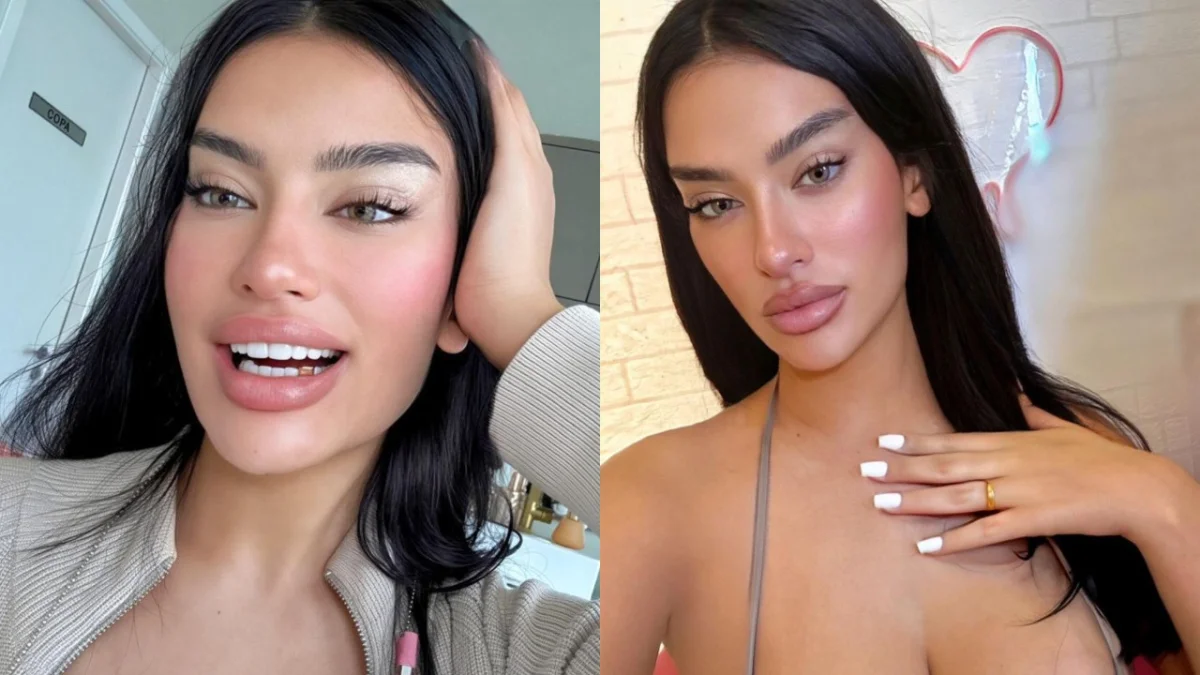 Influenciadora derrete aliança e cria grillz após traição