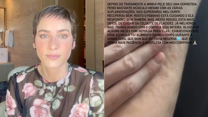 Dani Gondim revela repulsa às mudanças nas pernas pós-quimioterapia