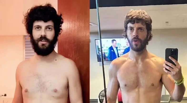 Diogo Defante mostra antes e depois após remoção de tumor