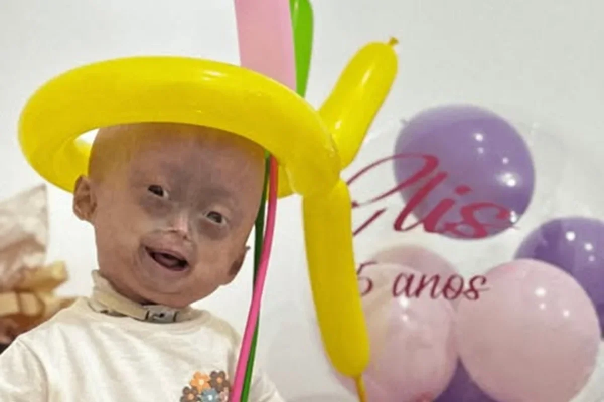 Elis Lima Carneiro: menina com progéria morre aos 5 anos