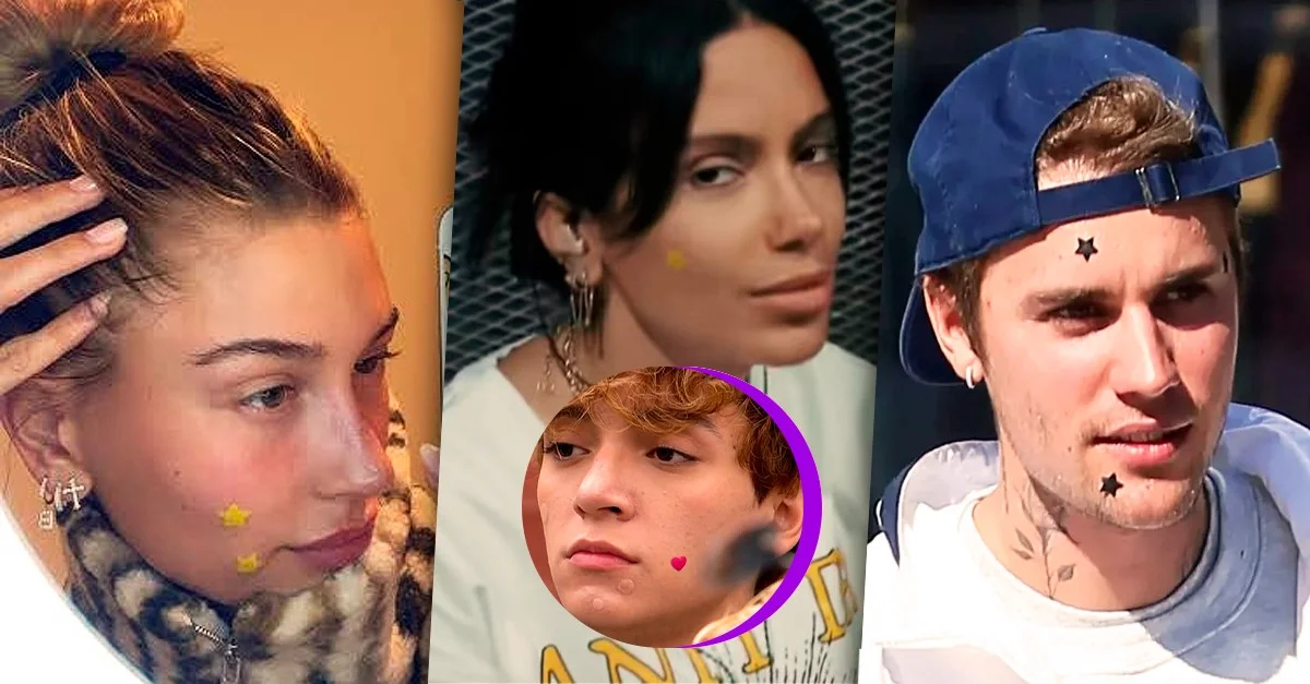 Estrelas da Casa: adesivos para espinha viram tendência entre famosos