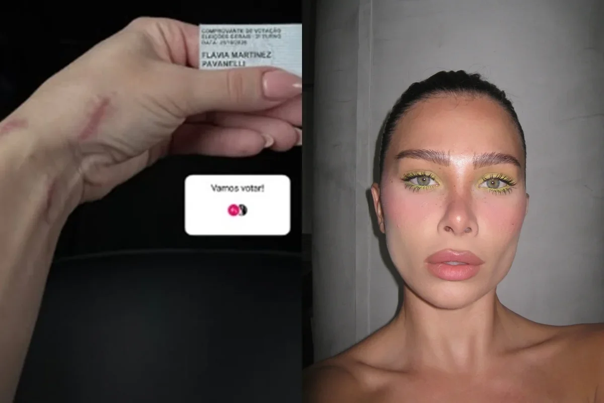 Flávia Pavanelli mostra cicatrizes nas mãos após acidente no box