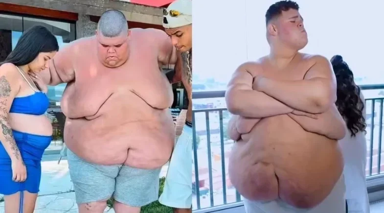 Gordão da XJ quer perder mais 70 kg após eliminar 140 kg