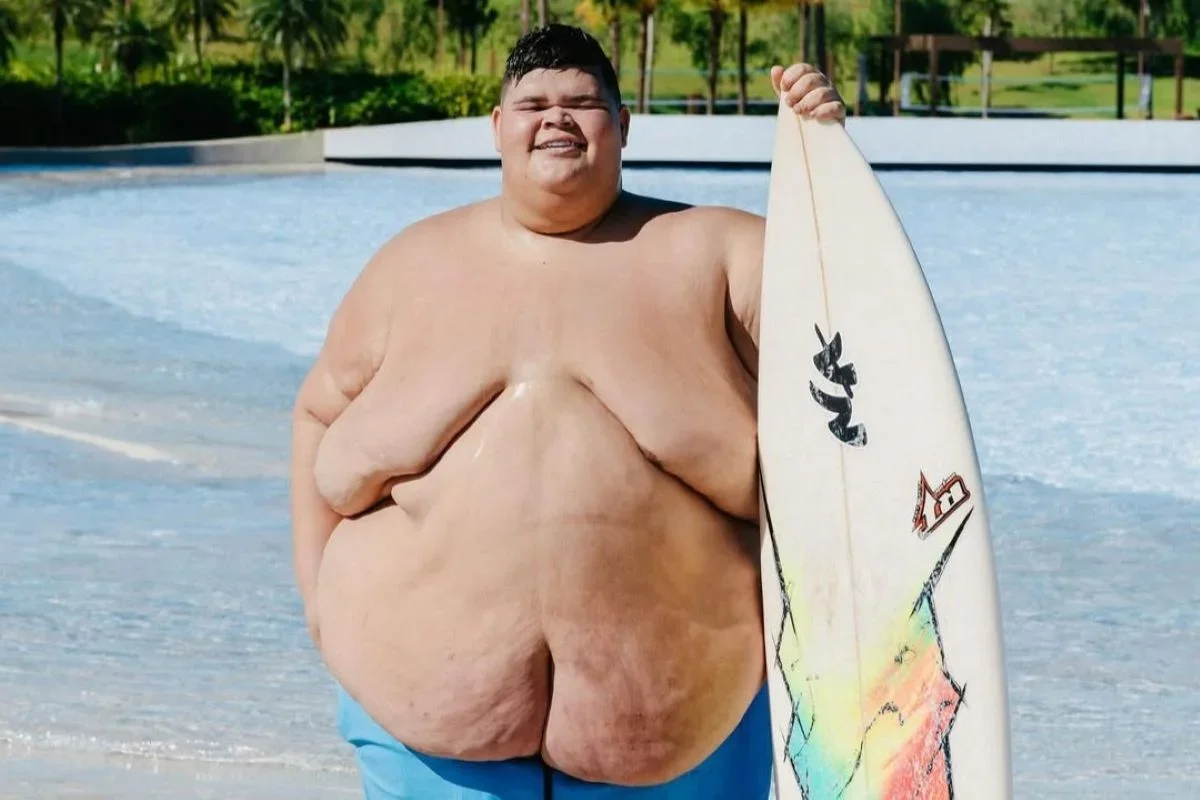 Gordão da XJ usa biquíni da noiva após perder 130 kg