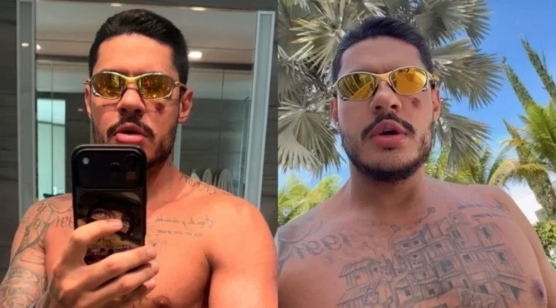 Hungria Hip Hop mostra escoriações e lesão no braço após queda de moto