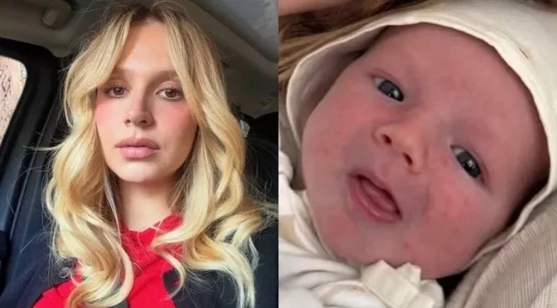 Isabella Scherer troca óleo por creme após notar acne em Tom
