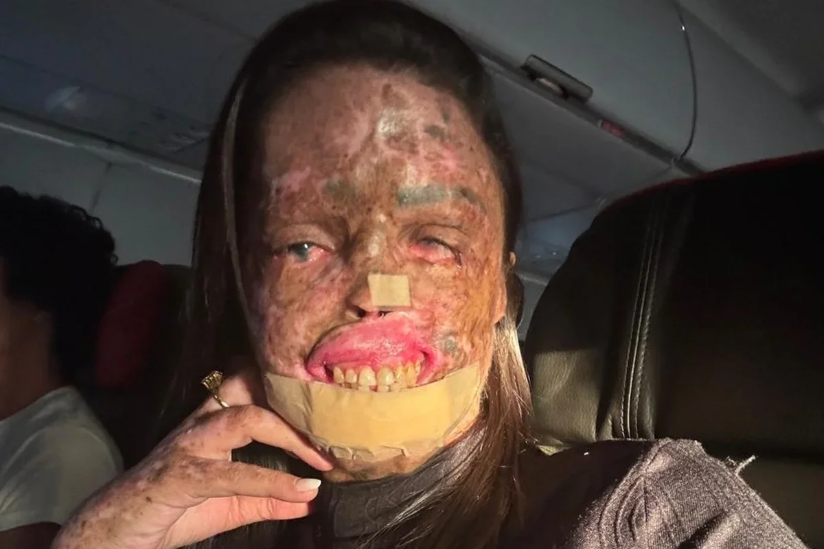 Karine Felipe: influenciadora morre após luta contra câncer
