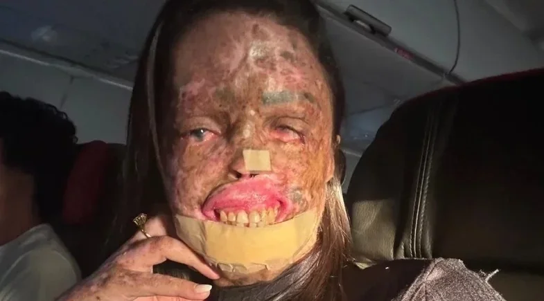 Karine Felipe: influenciadora morre após luta contra XP