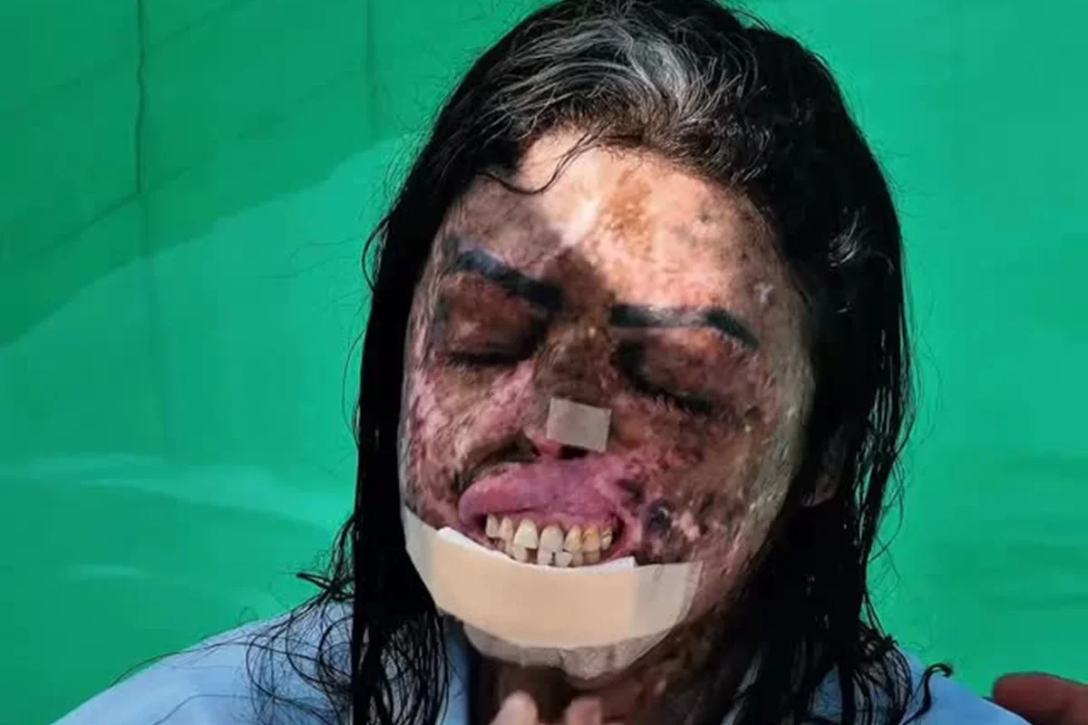 Karine Felipe: influenciadora que passou por 250 cirurgias morre