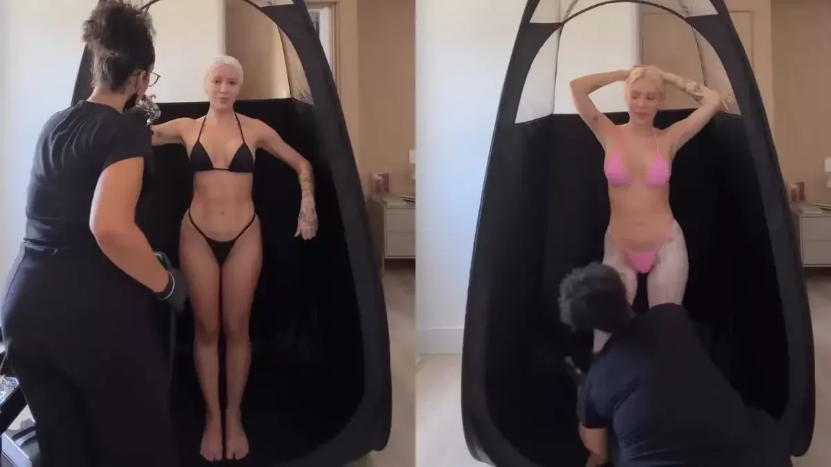 Karoline Lima evita bronze no sol após reação que causa bolhas