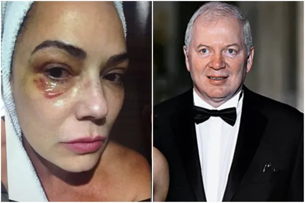 Lírio Parisotto é condenado a pagar R$ 150 mil por agressão