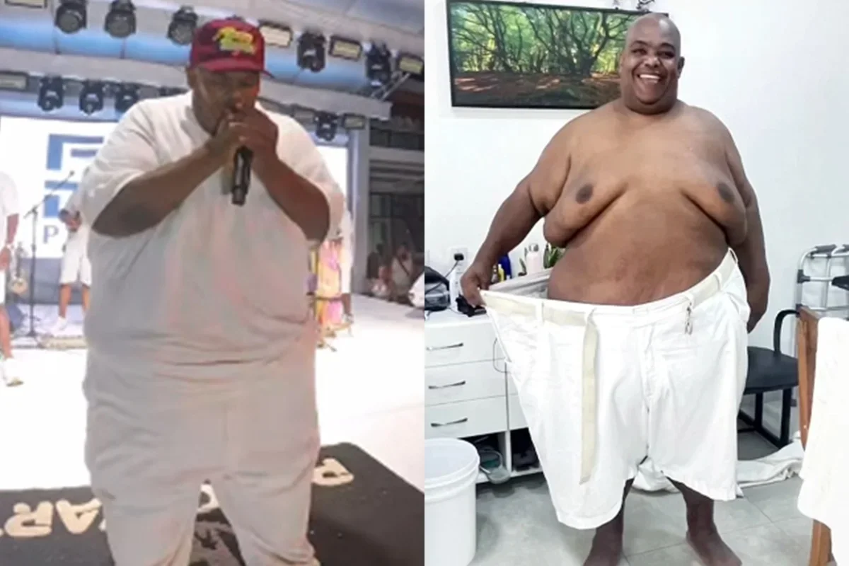 Luciano Babu perde 108 kg e faz bariátrica para voltar ao palco