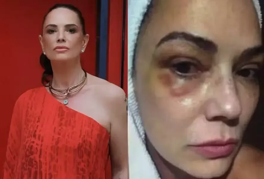 Luiza Brunet reage após condenação de Lírio Parisotto