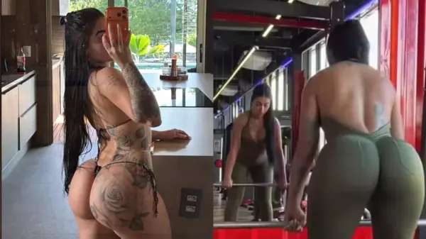 MC Mirella nega ter PMMA e ácido hialurônico no bumbum