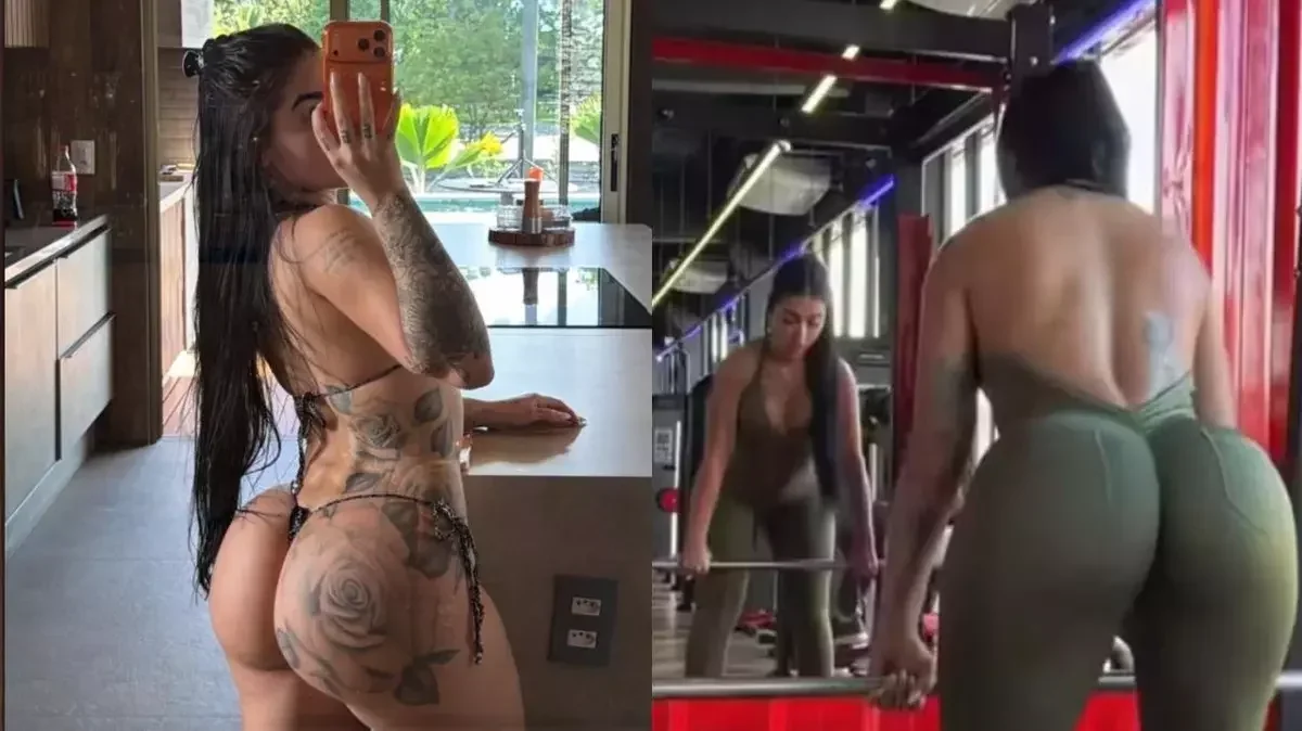 MC Mirella nega ter PMMA e ácido hialurônico no bumbum