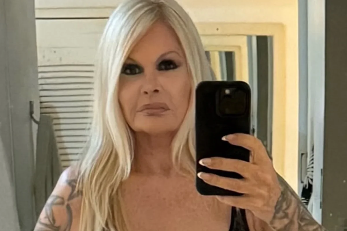 Monique Evans mostra novo rosto e recuperação evolui