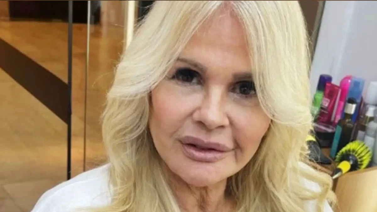 Monique Evans: 'orelha parece um bicho do mar' após minilifting