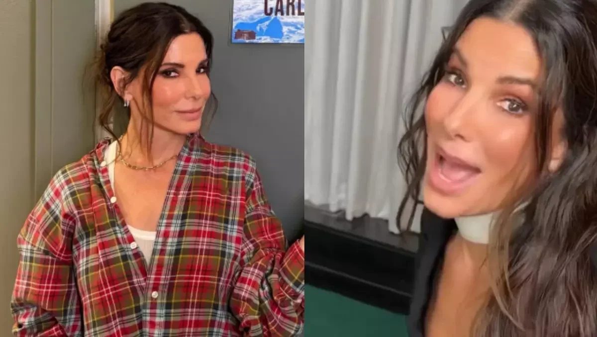 Sandra Bullock revela queda de cabelo e médico explica atraso