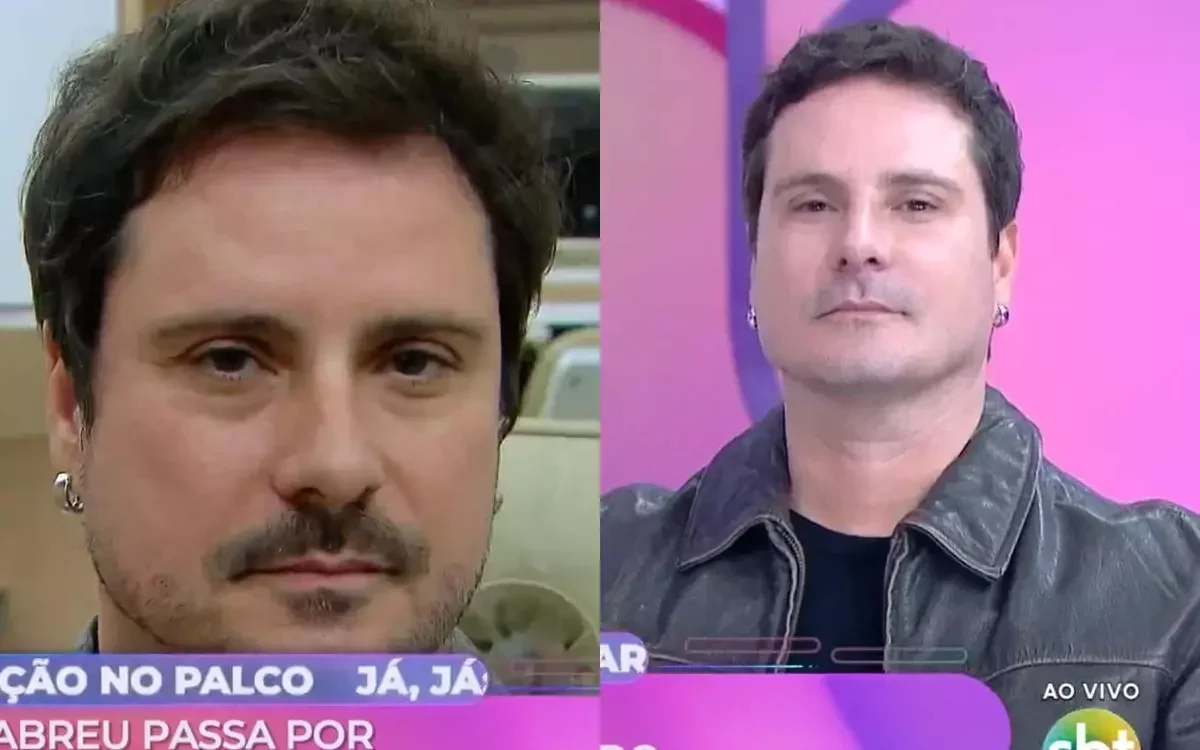 Sérgio Abreu: nariz surpreende após harmonização no SBT
