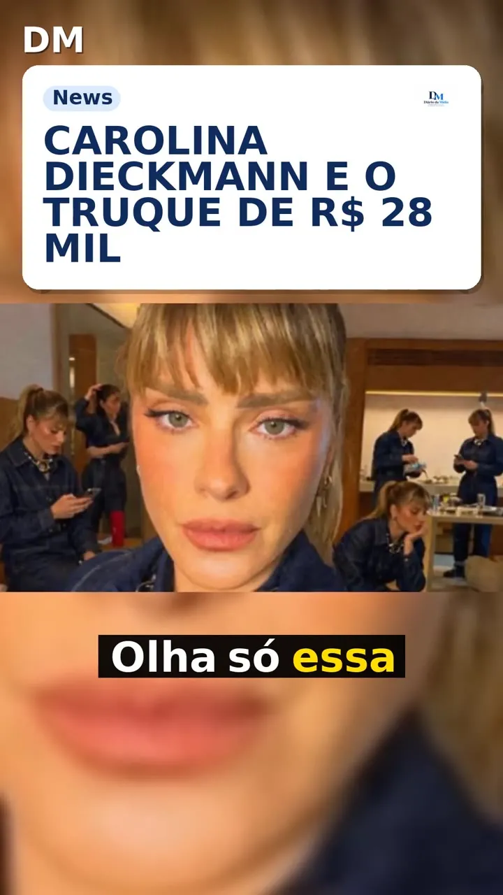 Carolina Dieckmann aposta em radiofrequência que pode custar R$ 28 mil