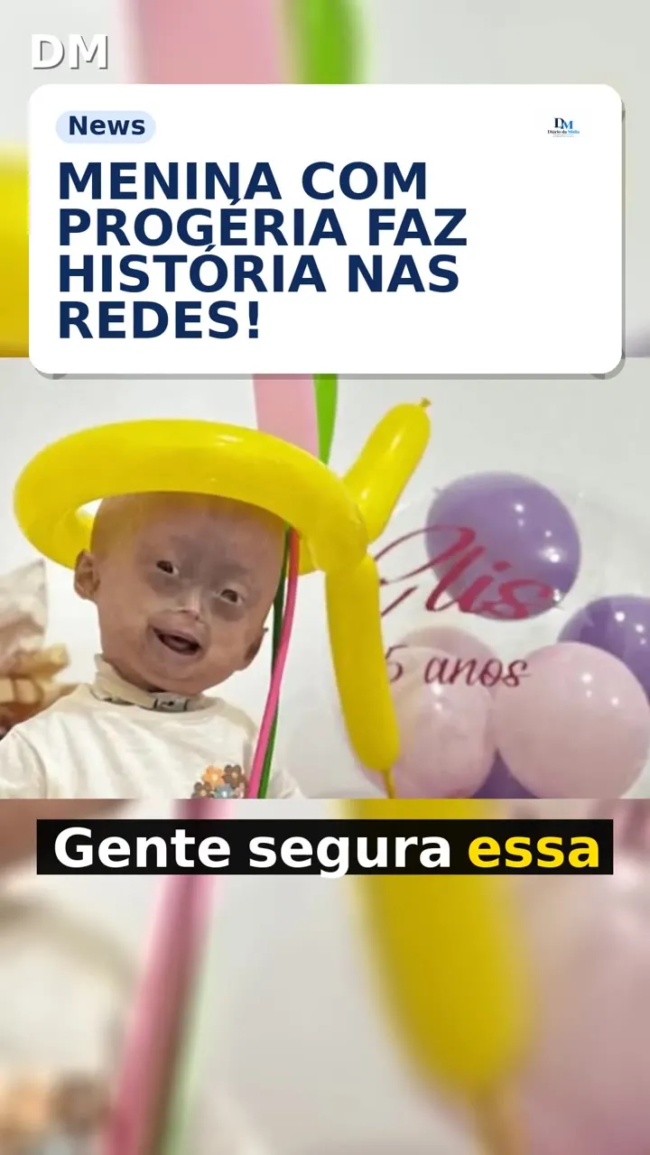 Elis Lima Carneiro: menina com progéria morre aos 5 anos